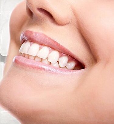 Odontologia Estética