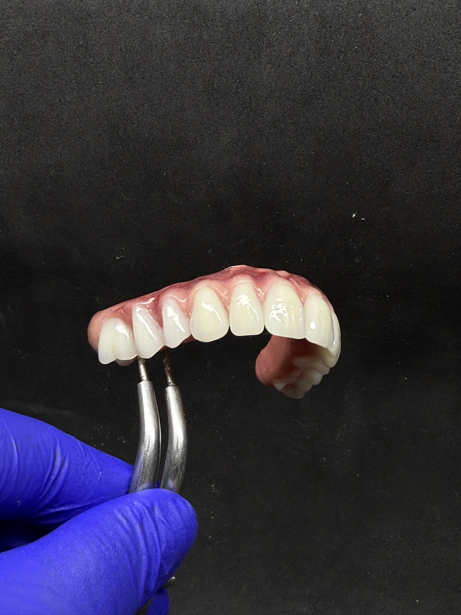 Diagrama de Prótese Dentária