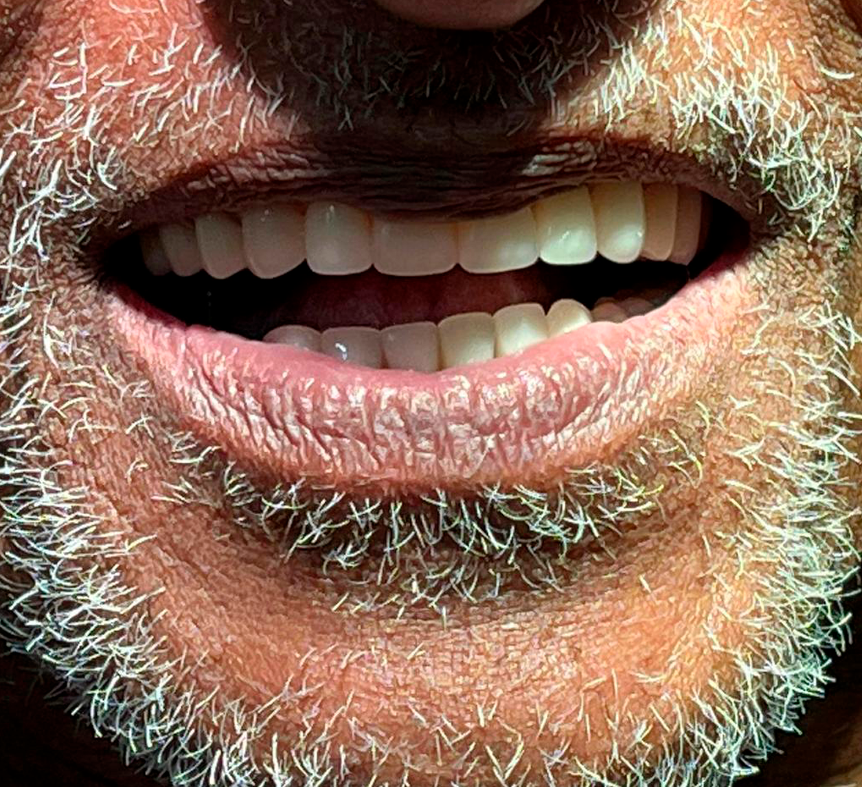 Equipamentos de ponta